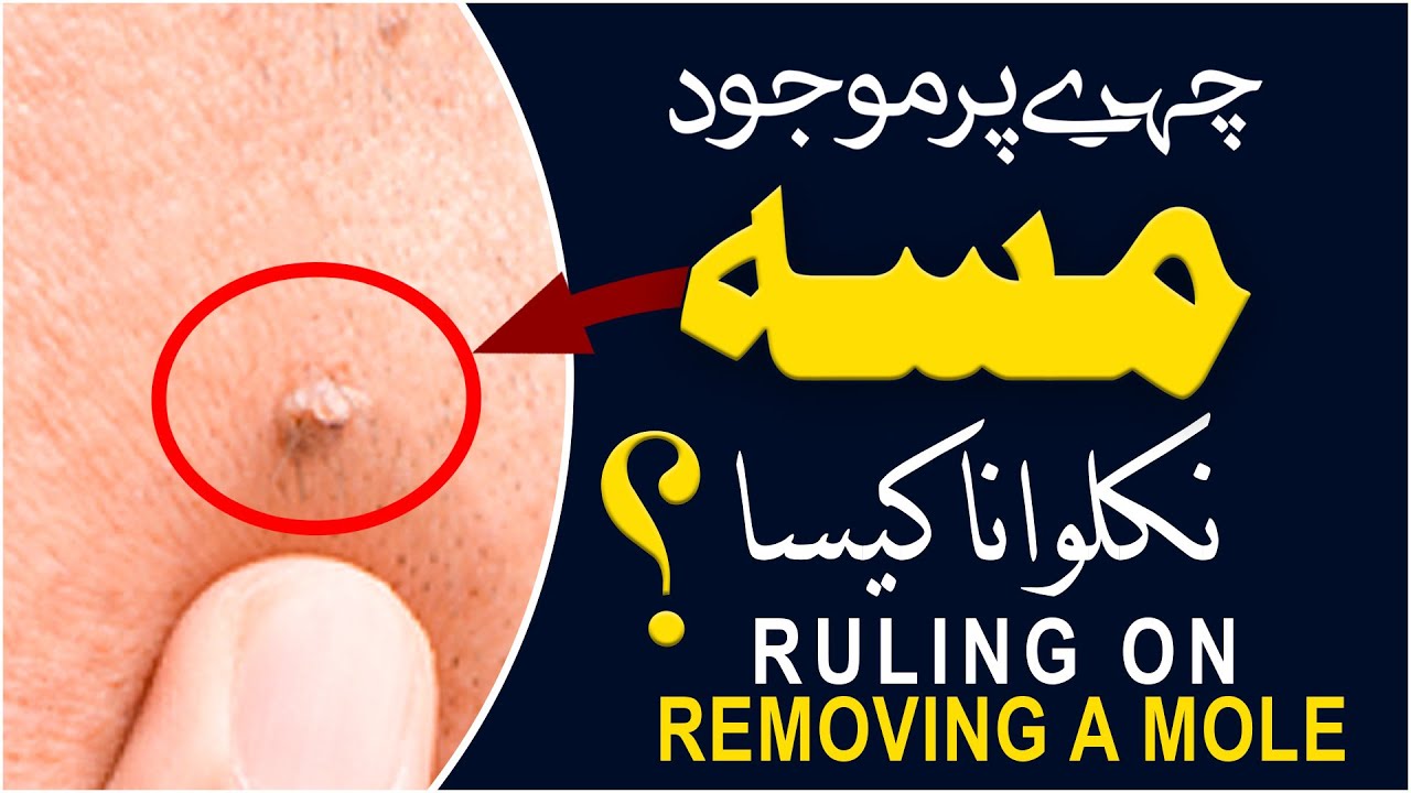 Face Par Se Masse Nikalwana Kaisa?